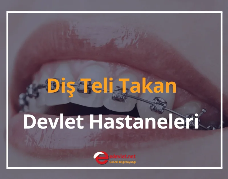 Diş Teli Takan Devlet Hastaneleri ve Fiyatları 2025